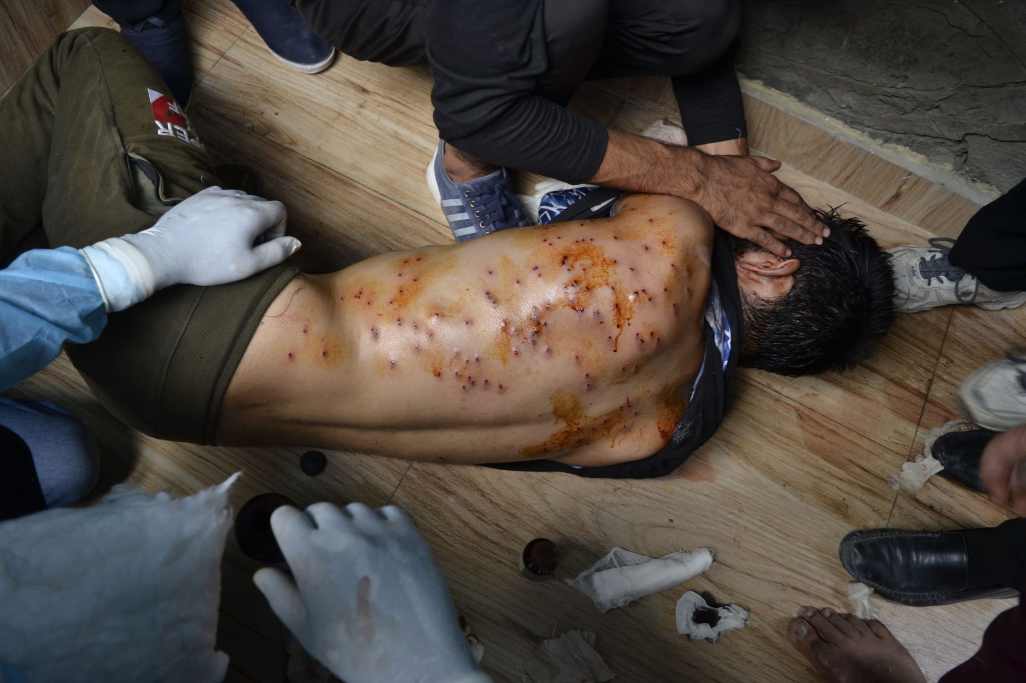 Aug. 30, 2020, Srinagar, Kashmir — A Muharram mourner is riddled with pellets during an Ashura procession in Zadibal. More than 44 people were injured, with some left partially blinded due to pellet injuries.